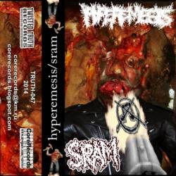 SRAM : SRAM - Hyperemesis